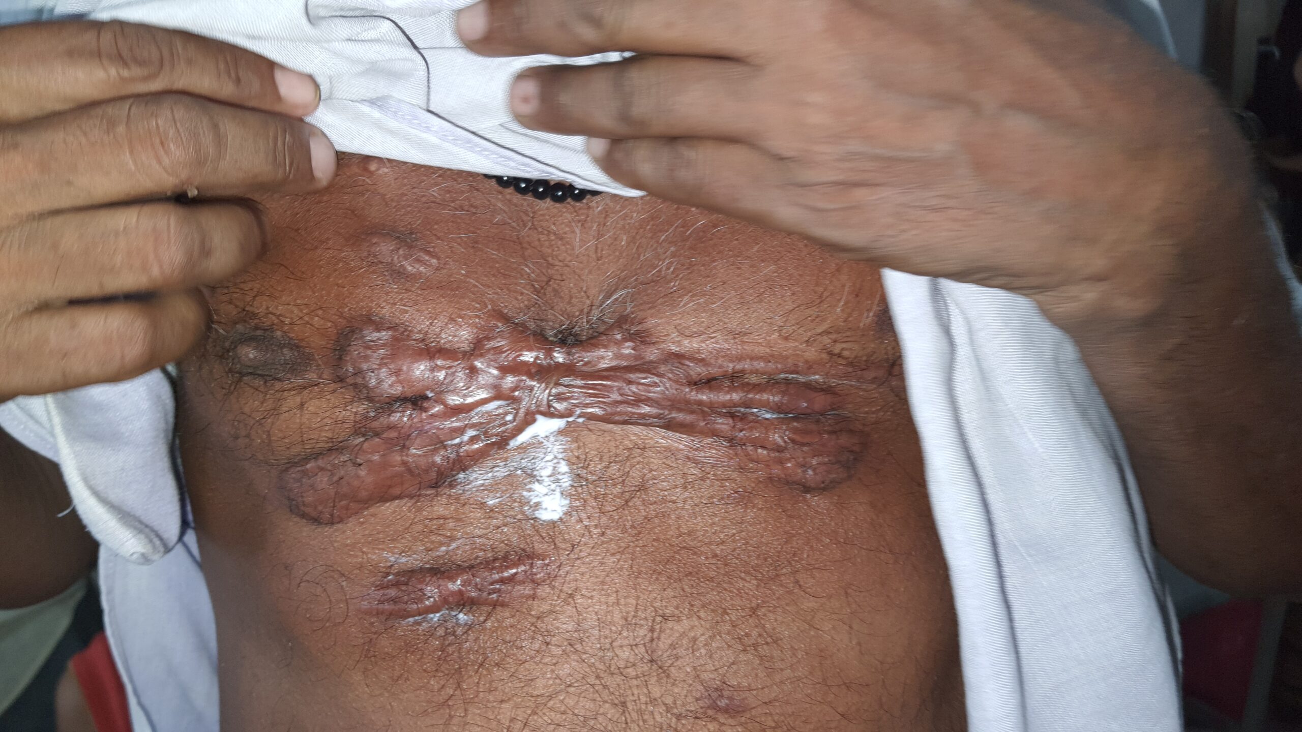 Arpit gupta (from TCML)