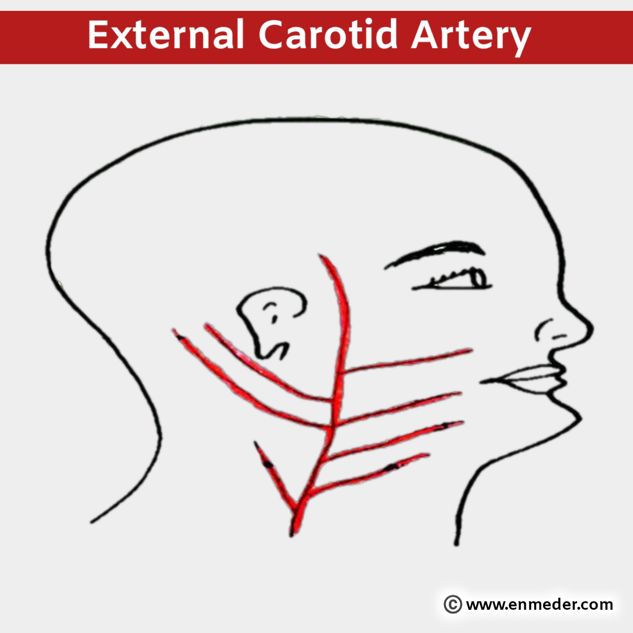 carotid-artery-tcml-the-charsi-of-medical-literature