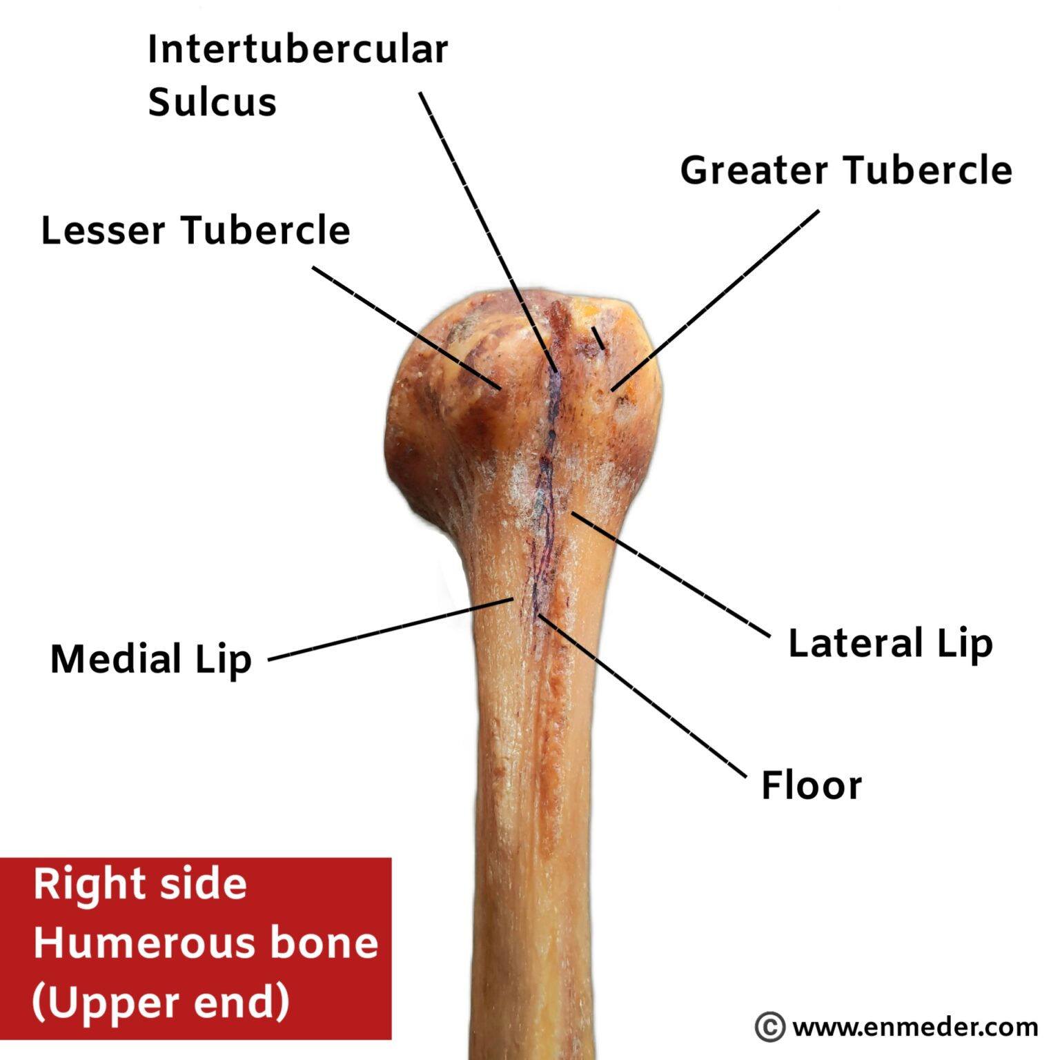 Bicipital groove TCML The Charsi of Medical Literature