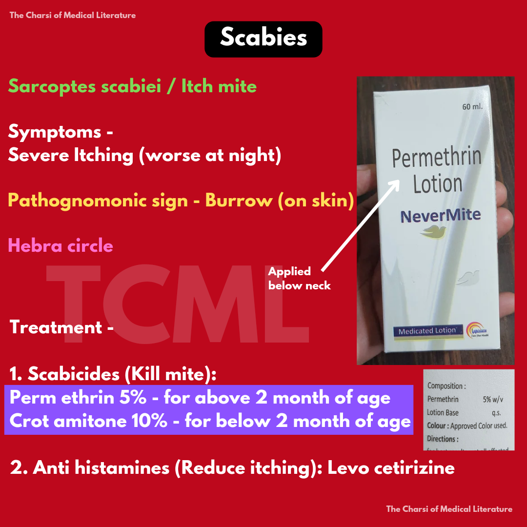 Scabies, tcml