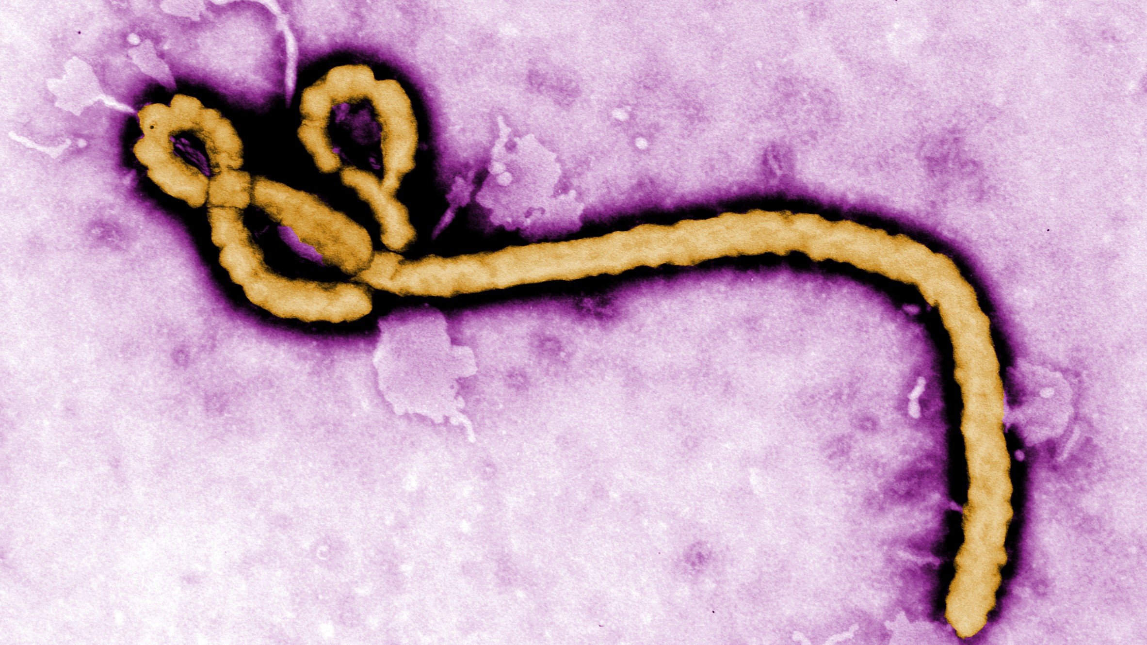https://www.cdc.gov/ebola/about/index.html