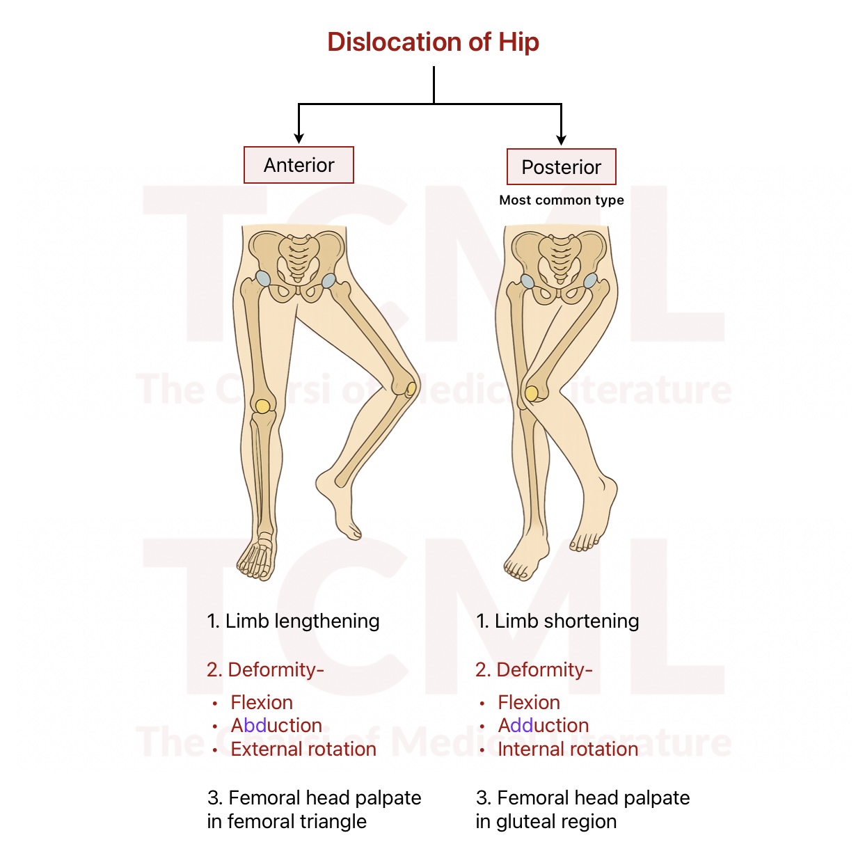 Hip dislocation