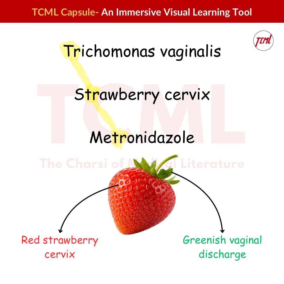 Trichimonas vaginalis Trichimonas vaginalis